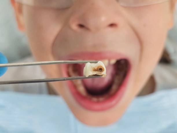 Best Urgent Dental Care for Toothache in Richland Hills, TX